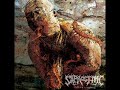 Saprogenic - Trepanation