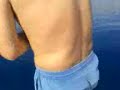 Thumbnail #2