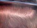 IAHRS Member Dr. Feller- Tricho Closure