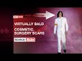 Leaked out autopsy of Michael Jackson