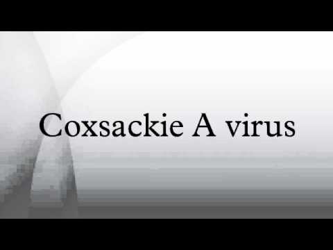 how to treat coxsackie b virus