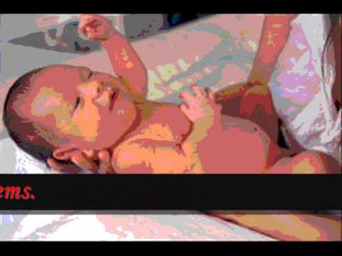Fetal Alcohol Syndrome