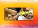 Byetta Associated with Necrotizing Pancreatitis