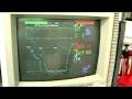 Anesthesiologist Interview