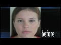 Organic Acne Treatment - Oeco