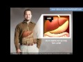Diabetes: Metformin medication