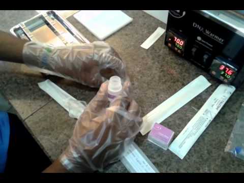 how to treat sperm dna fragmentation