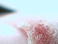 watch closely bottom of screen/sore worms in finger sore watch closely bottom of screen/sore worms in finger sore