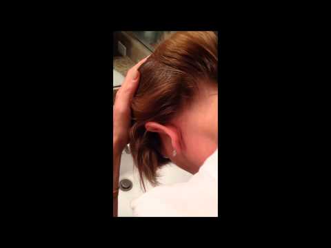 how to check yourself for lice