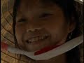Medical Congress Video
