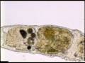 videos de Chaetogaster