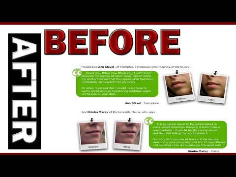 how to use e-cure treatment