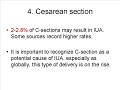 Asherman's Syndrome (intrauterine adhesions) Dilation And Curettage