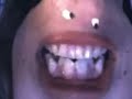 Joelbitar