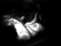 Fluorescent Identification Of The Middle Cranial Artery - Part 1 Fluorescent Identification Of The Middle Cranial Artery - Part 1