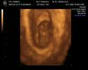 Our MVP (Most Valuable Peanut) Baby @ 9 Weeks Our MVP (Most Valuable Peanut) Baby @ 9 Weeks