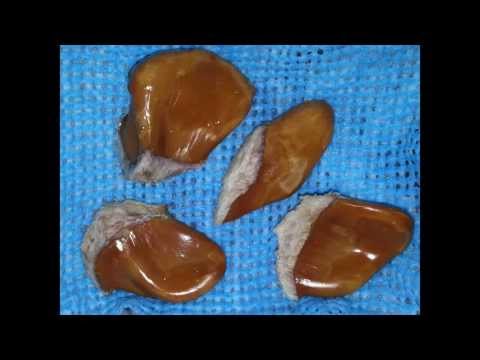 how to grow durian tree