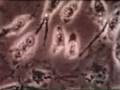 Cellules intoxiquées par eau fluorée-Preuve vidéo