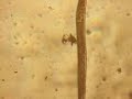 Spirostomum