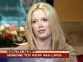 lupus-on-good-morning-america.html