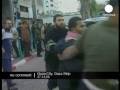 Casualties arriving at hospital after Israel's air force fired missiles in the Gaza Strip