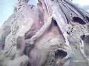 Anatomia II BR