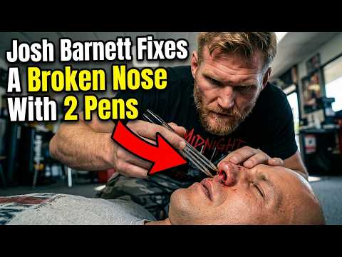 featured VIDEO: TIP OF THE DAY: HOW TO FIX A BROKEN NOSE USING PENS! photo