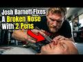 Strikeforce's Josh Barnett Fixes A Broken Nose With Two Pens + Bad Puns