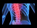 Fluoride Risks for Kidney Patients (Wide Screen Version)