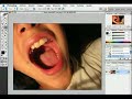 Blanquear dientes