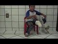 Alessandro Protese para Crianca - Ortopedia Conforpes