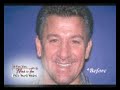 Palm Beach Smiles - Michael I. Barr, DDS