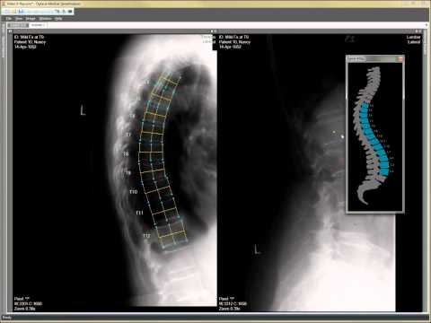 how to assess an x ray