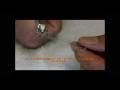 All-Wire-Retainer-in