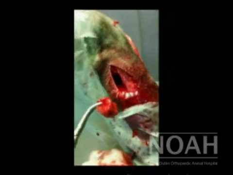 how to treat rcvs