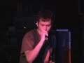 fetal-alcohol-syndrome.html