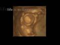 4D Ultrasound - Pre-born Baby At 16 Weeks - Pro-Life Anti-Abortion Video PSA