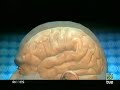 La leptina y la obesidad