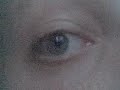 My right Eye