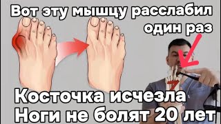 Косточка на стопе исчезает навсегда. Расслабил эту мышцу и ноги не болят уже 20 лет