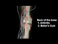 Dr Farshchian  location of Knee pain