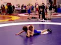 Wrestling broken arm (Warning, may disturb some)