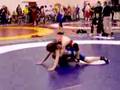 Wrestling-broken-arm