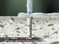 Sonic-Weld Rx Kls Martin Membrane riassorbibili Sonic-Weld Rx Kls Martin Membrane riassorbibili