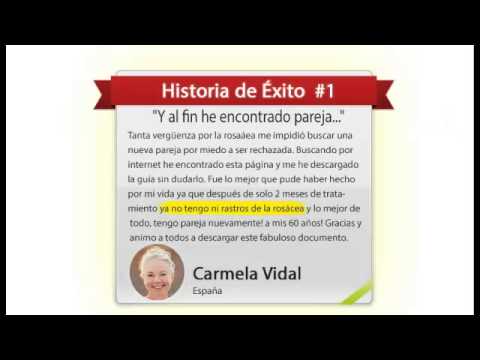 how to treat ocular rosacea