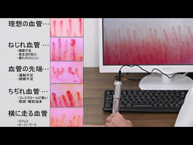 高速オートフォーカス血流スコープ HJ-G6(毛細血管スコープ)は 高速オートフォーカス血流スコープ HJ-G6(毛細血管スコープ)は