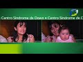 Down syndrome:&nbsp;S�ndrome de Down: Centro de apoyo