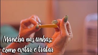 Fica a Dica - Mancha nas unhas: como evitar e tratar