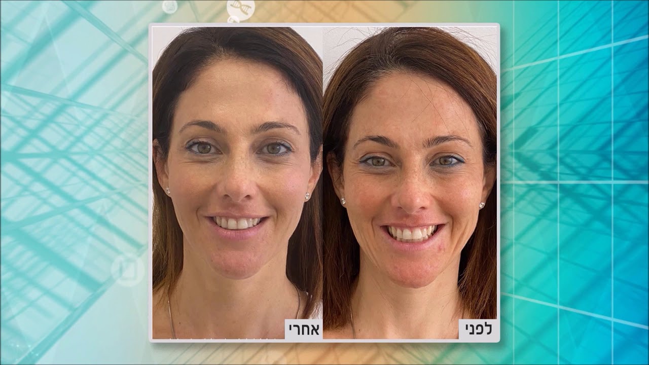 נעמי שרון כיצד נעניק לעור מראה צעיר ובהיר  90