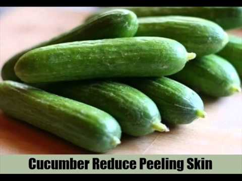 how to cure peeling skin